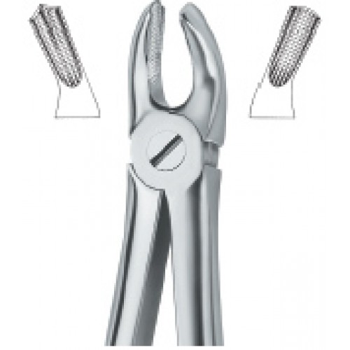 Molars , Right 17